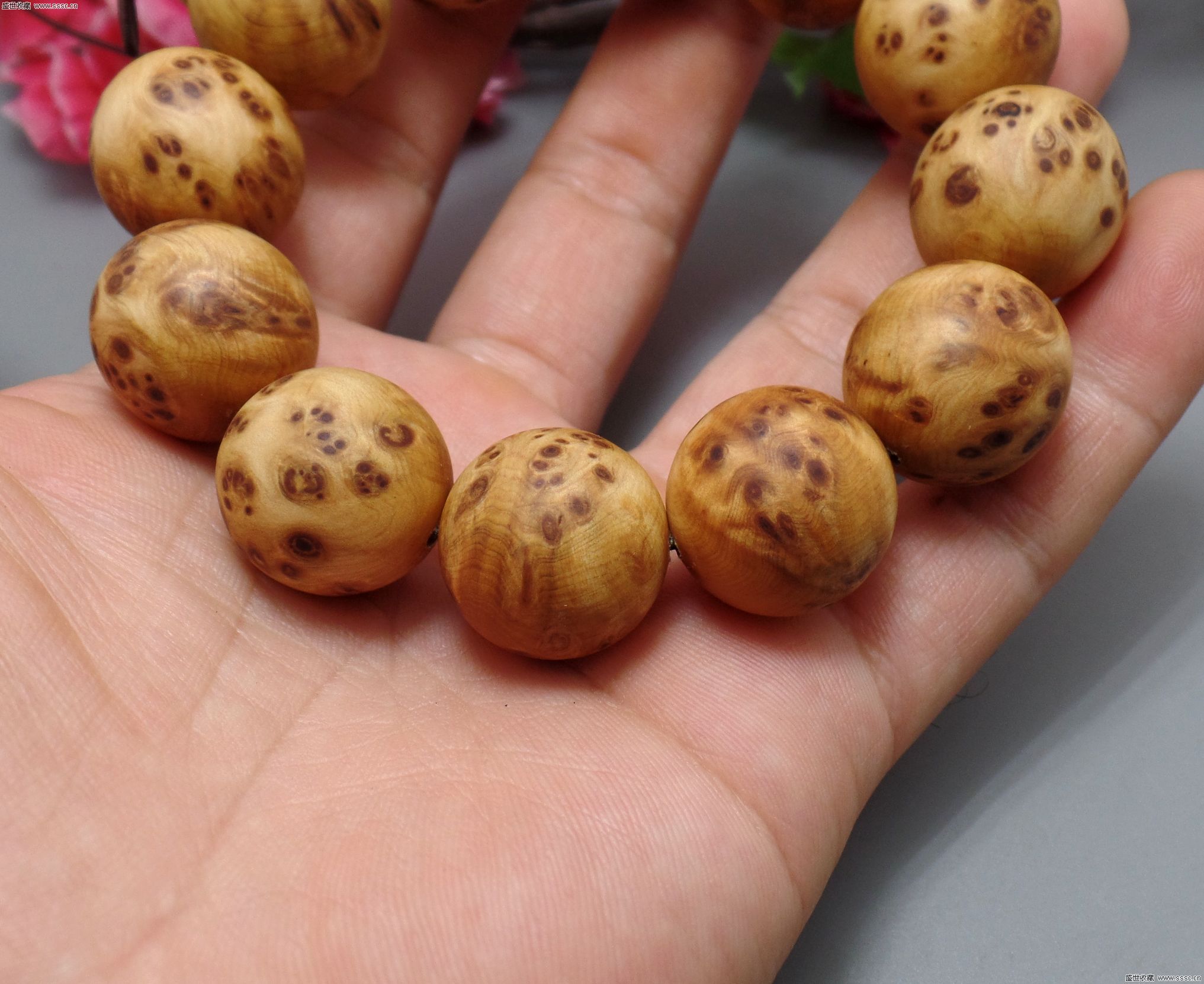 肝积水应该怎样治疗呢_太阳成集团tyc7111cc(图2) 太阳成集团tyc7111cc